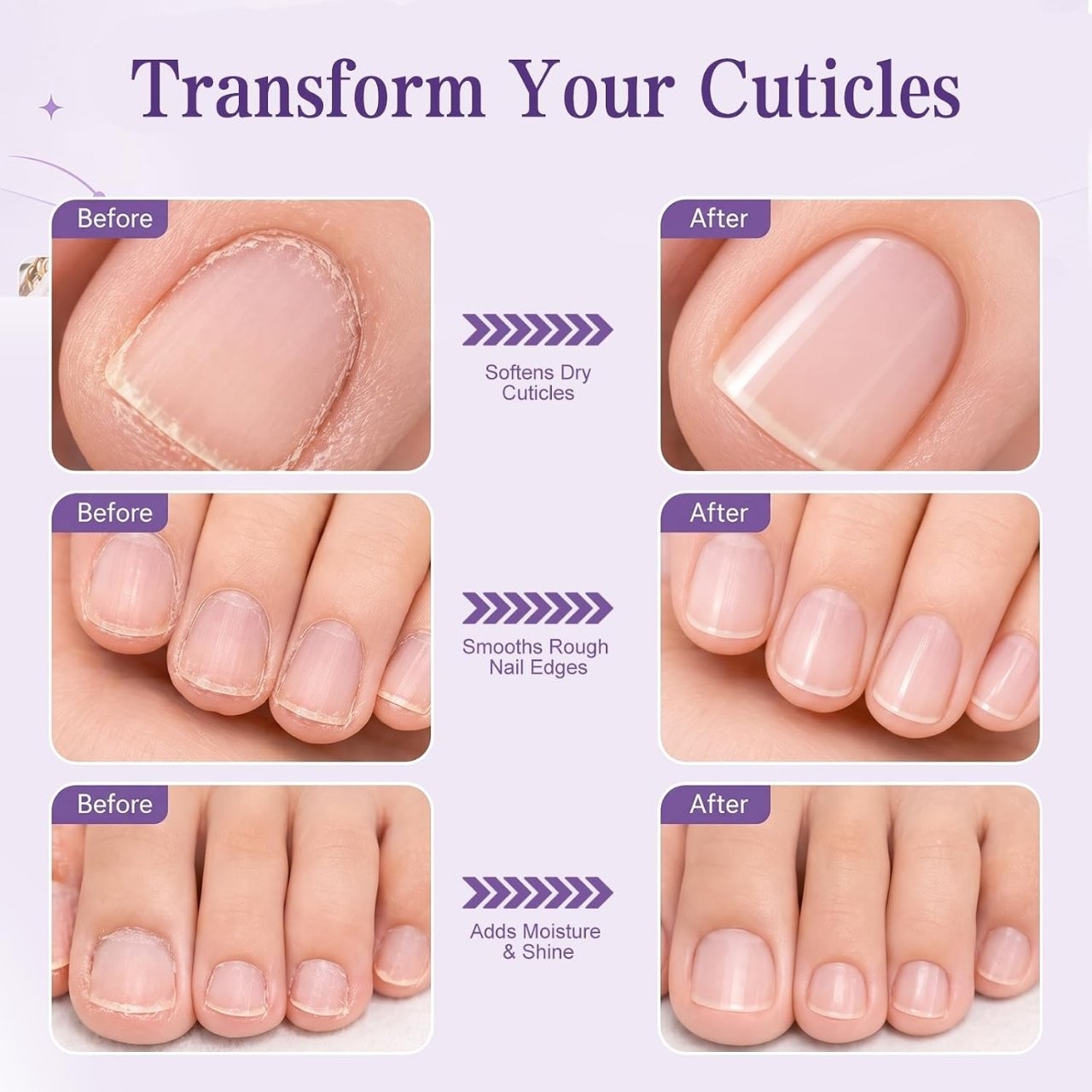 Penna 2-in-1 per la cura delle cuticole, CuticleOil - Image 9