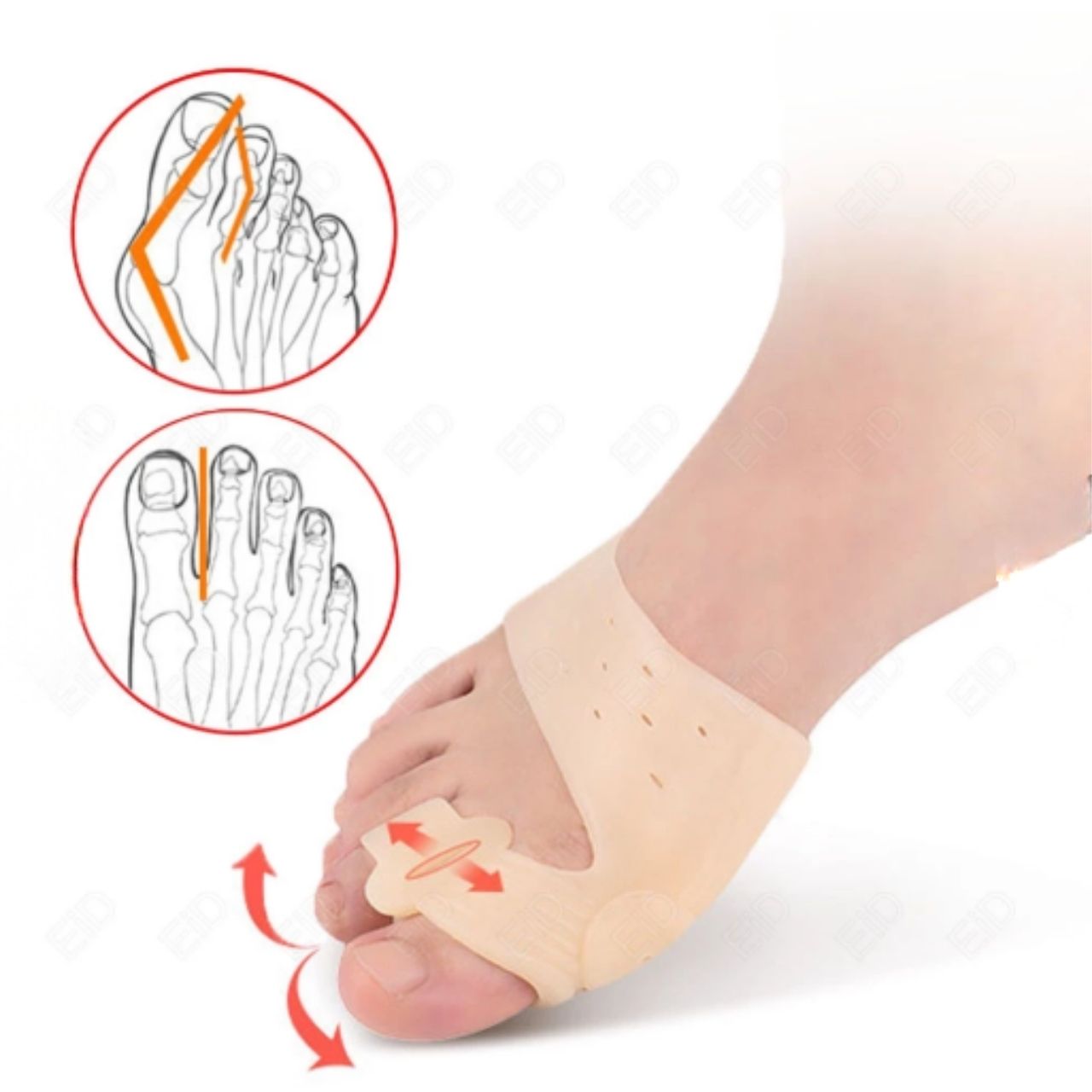 ToeCorrect, un tutore per la correzione delle dita dei piedi